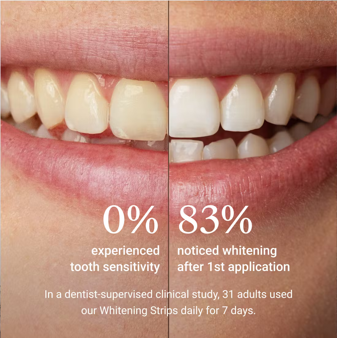 ReBrush PAP+ Whitening Strips